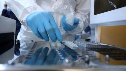 İngiltere'nin sipariş ettiği test kitlerine koronavirüs bulaştı