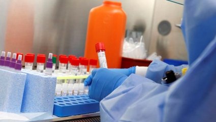 Japonya koronaya iyi gelen ilacı isteyen ülkelere ücretsiz verecek