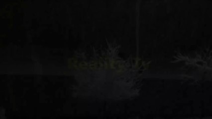 Story Of Liam Derbyshire - People Going Through Strange And Rare Conditions - Ese Larky ki Kahani Jo Soya Tw Mar Jayega