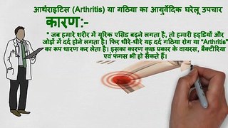 Arthritis ke lakshan, kaaran aur gharelu upchar | आर्थराइटिस (गठिया रोग) के कारण, लक्षण और घरेलु उपचार | Arthritis treatment in Hindi
