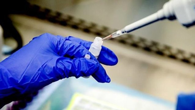 Koronavirüs aşısında ilk adım atıldı! Prof. Dr. Aykut Özkul Kovid-19'u izole etmeyi başardı