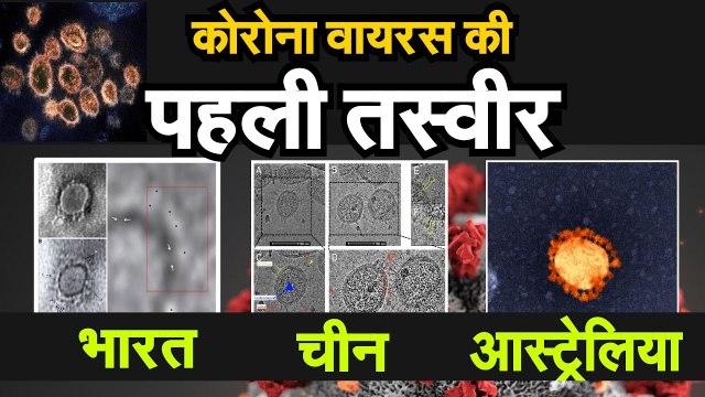 coronavirus first image from india कोरोना की पहली तस्वीर देखिए कितना अलग है चीन और भारत का virus