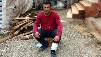 Koronavirüse yakalandığını zanneden şahsı, akrep soktuğu ortaya çıktı
