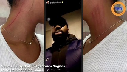 Vegedream accusé de violences conjugale saprès que son ex compagne ait dévoilé des images choquantes, il nous donne sa version.