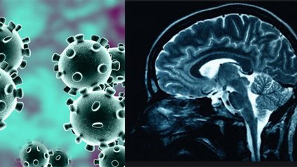फेफड़ों के बाद Coronavirus ने दिमाग को जकड़ा, Scientists का दावा | Coronavirus Brain Damage |Boldsky