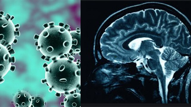 फेफड़ों के बाद Coronavirus ने दिमाग को जकड़ा, Scientists का दावा | Coronavirus Brain Damage |Boldsky