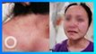 Pasien Covid-19 gigit wajah perawat akan dipidana setelah sembuh di China - TomoNews