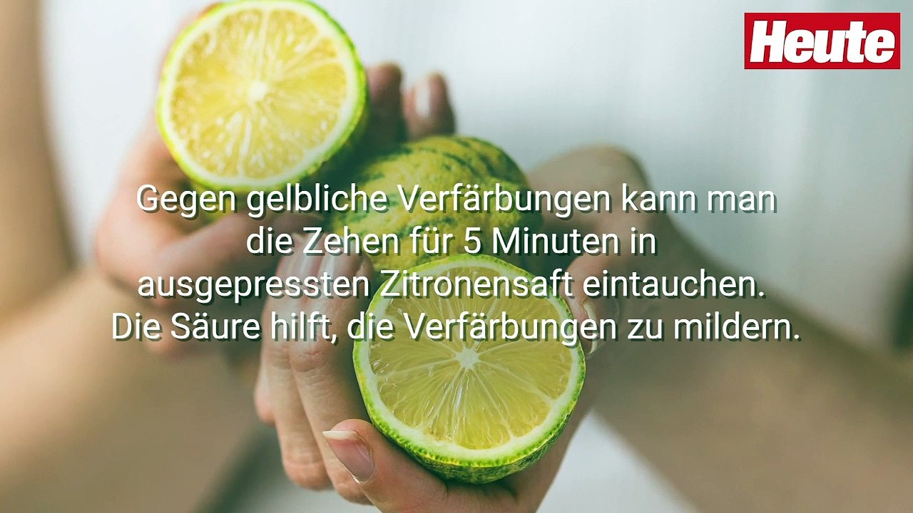 Beauty-SOS: DIY-Pediküre in 5 Schritten