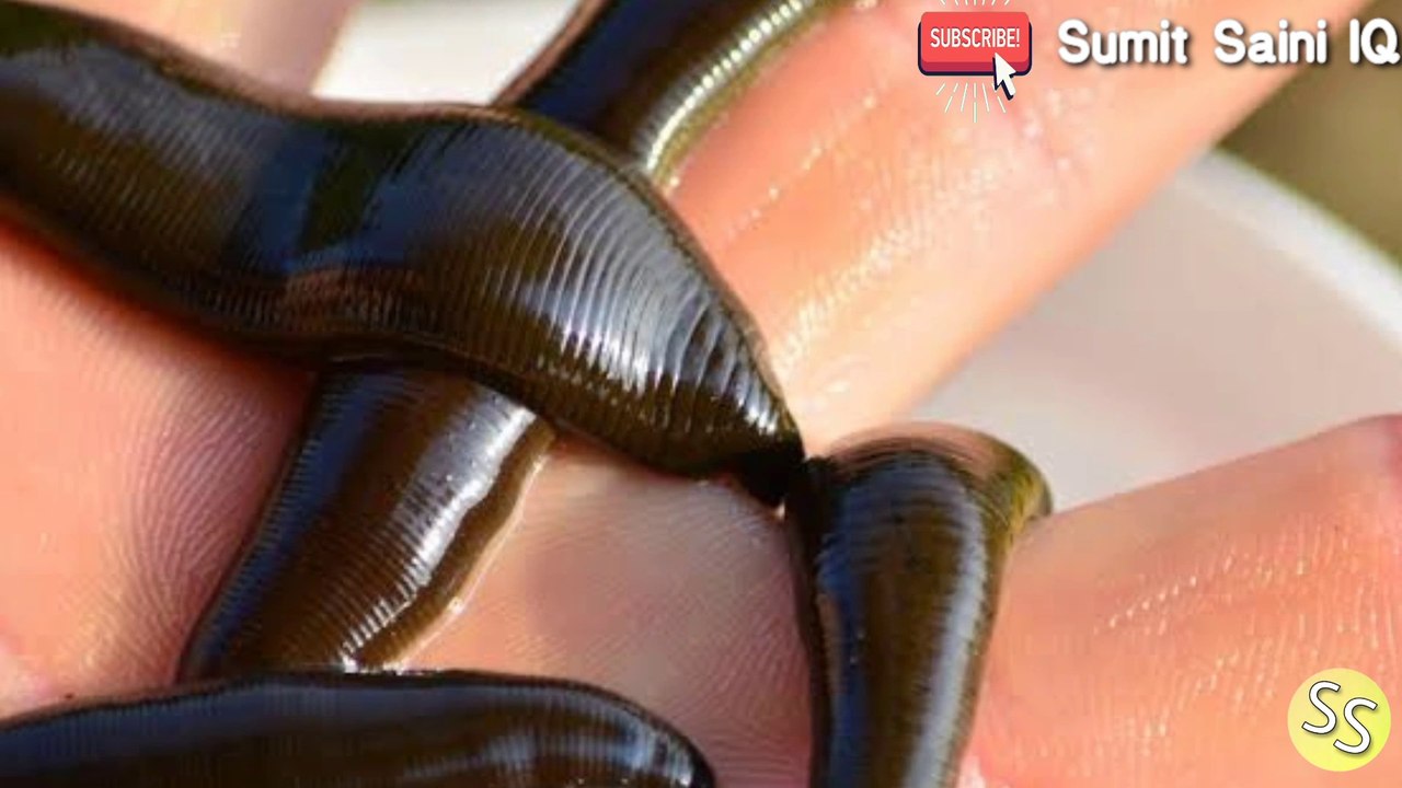 एक के गले में मिली जोंक || Leech in one's neck || Sumit Saini IQ