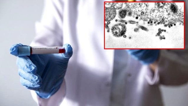 Koronavirüsün hücrelerde yarattığı tahribat elektron mikroskobu ile görüntülendi