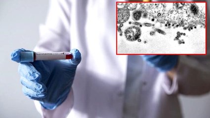 Koronavirüsün hücrelerde yarattığı tahribat elektron mikroskobu ile görüntülendi