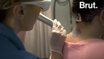 Removing Tattoos to Help Abuse Victims Heal