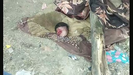 झोपड़े में मिला नवजात बच्चे का सिर