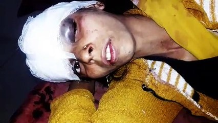 शराब के नशे में पति ने पत्नी को लाठी