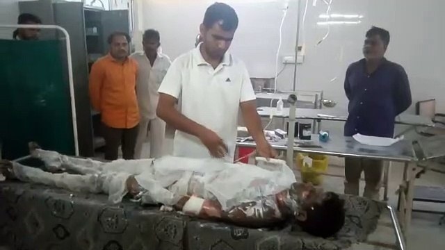 रातभर गैस रिसाव, सुबह हुआ विस्फोट, चार श्रमिक झुलसे