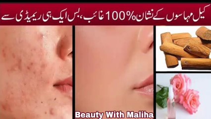 Acne spot removal treatment at home in urdu | Home remedy for acne spot | Beauty tips