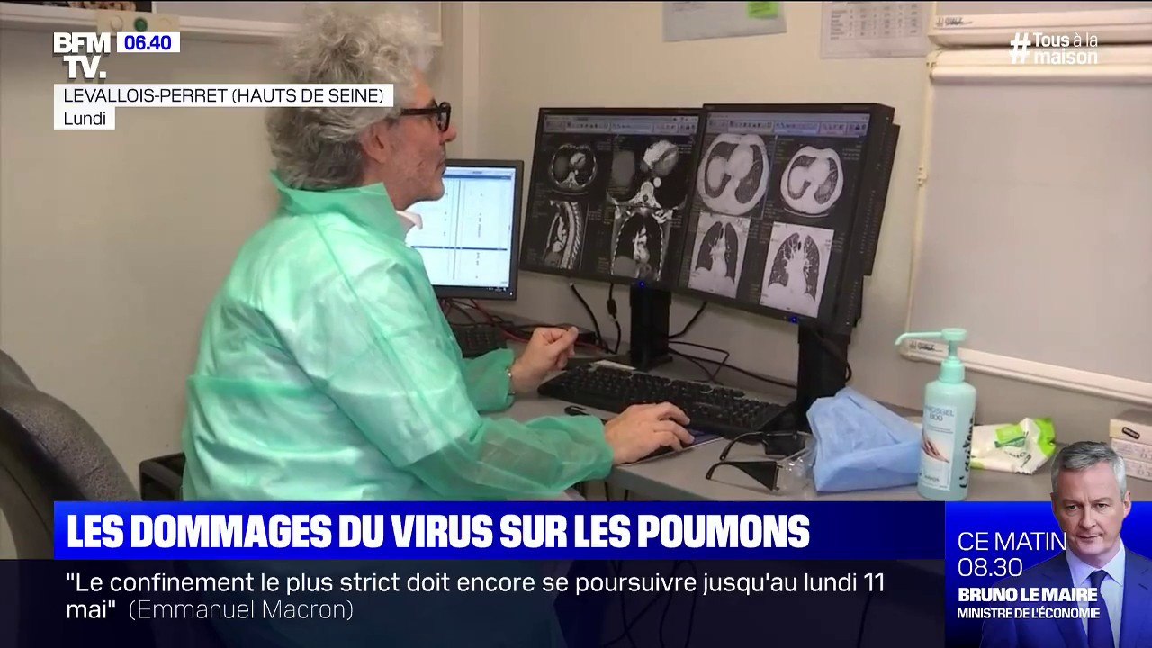 Comment le scanner thoracique permet de mieux prendre en charge les malades atteints du coronavirus