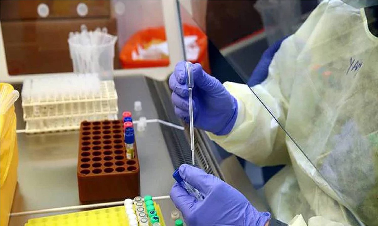Covid-19: How do they perform Coronavirus test?