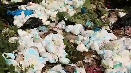 बच्चो  को Diaper पहनाना चाहिए या नहीं (Pros & Cons) || Bachho Ko Diaper Pehnana Chahiye Ya Nahi