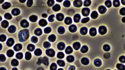 Kalcker da respuesta a las afirmaciones falsas