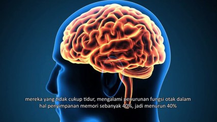 Apa Pengaruh Kurang Tidur Terhadap Kesehatan Otak