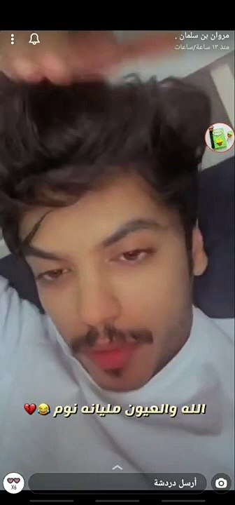 سنابات مروان العتيبي رجع سنابه مو قادر ينام مشتاق لمتابعينه