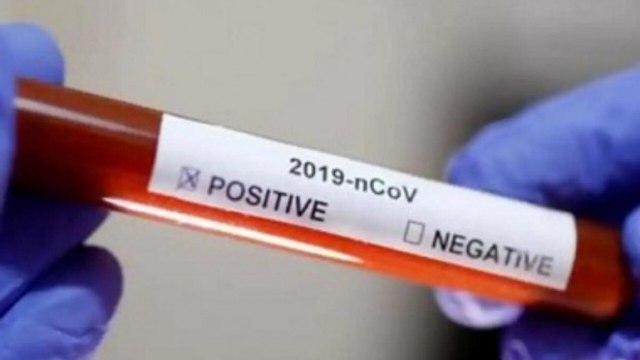 Covid-19: Enough testing kits available, says ICMR; 69 fresh cases in UP | Developments