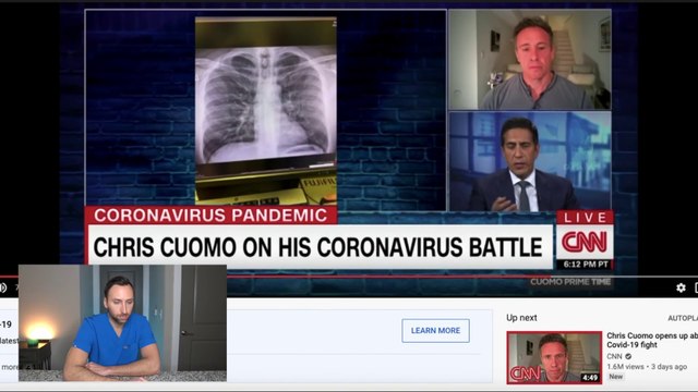 DOCTOR Explains Chris Cuomo's COVID-19 Chest X-ray - Coronavirus - CNN