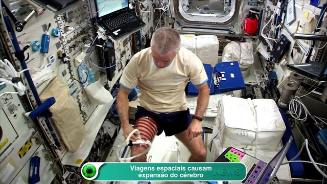 Viagens espaciais causam expansão do cérebro