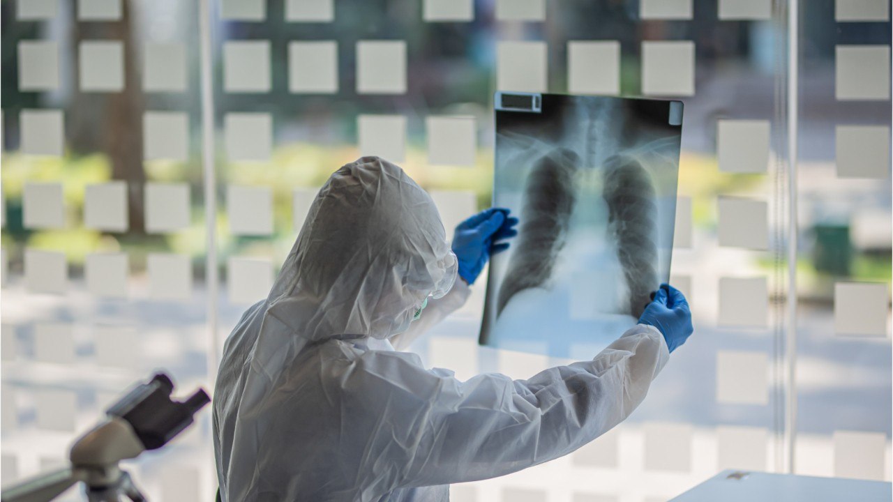 Exercise May Help Protect Against A Lethal Coro...