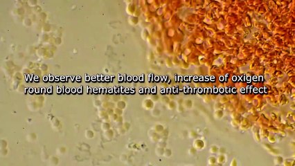 Dióxido de Cloro vs Covid-19 - Explicación científica