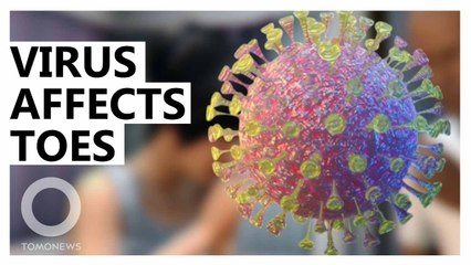 COVID toes: Potential new coronavirus symptom