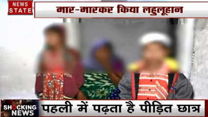 Chhattisgarh: 1 साल के मासूम का टीचर ने फोड़ा सिर