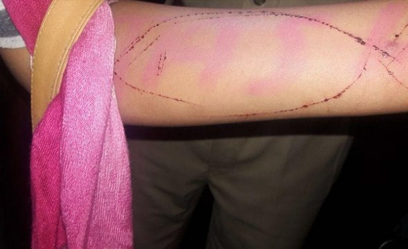 ब्लू व्हेल गेम: सुप्रीम कोर्ट ने माना 'राष्ट्रीय समस्या'