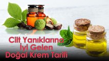 Cilt Yanıklarına İyi Gelen Doğal Krem Tarifi