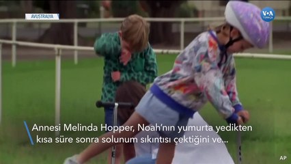 Araştırma Bebeklerde Gıda Alerjisi Riskinin Azaltılabileceğini Ortaya Koydu