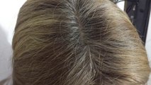 COMO ELIMINAR LAS CANAS NATURALMENTE CON REMEDIOS CASEROS _ AndyZarturno