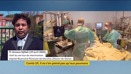 Coronavirus : de nouvelles anomalies détectées chez les patients