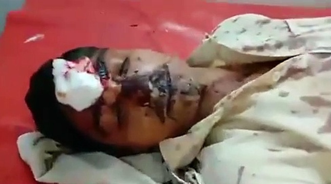 गाजीपुर थाने के चुरियानी गाँव मे दो पक्षों में हुवा विवाद ,कई घायल