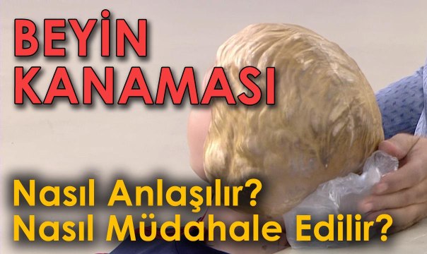 Beyin Kanaması Nasıl Anlaşılır ve Nasıl Müdahale Edilir?