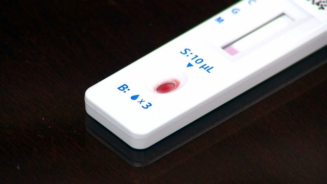진단키트 특수가 불러온 '바이오 한류'...미래 먹거리로 육성 / YTN