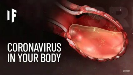 What Happens If You Caught The Coronavirus (2019-20 Corona virus pendamic)