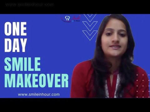 Instant Cosmetic Dental Veneers Review - One Visit Smile Makeover from Smile in Hour India