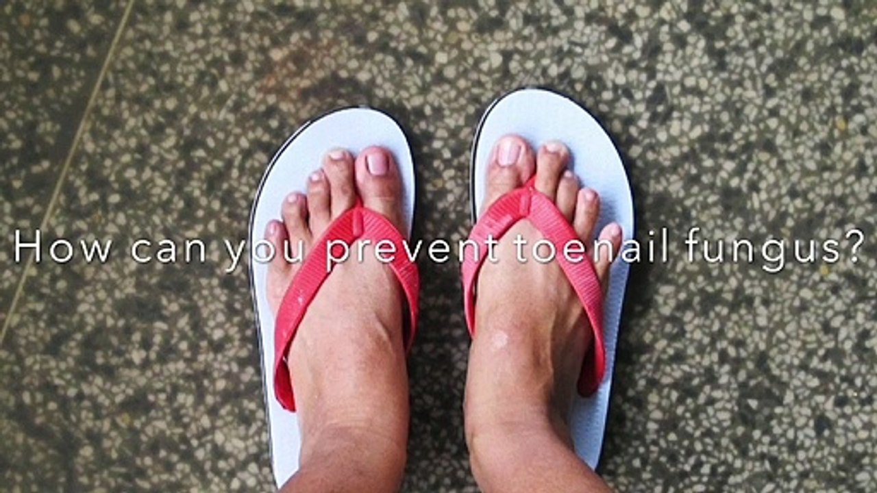 Toenail Fungus Questions Answered