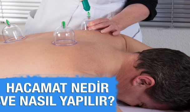 Hacamat Nedir ve Nasıl Yapılır?