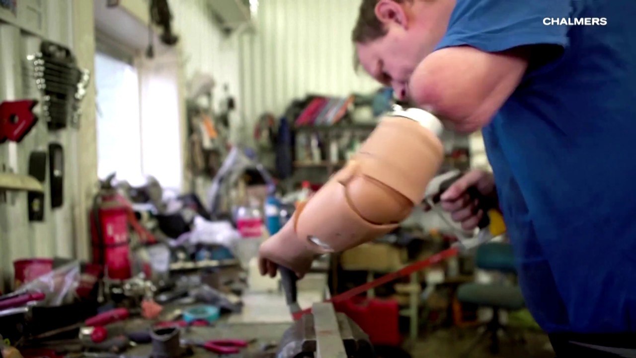 Mind-controlled prosthetic arm lets amputees feel touch