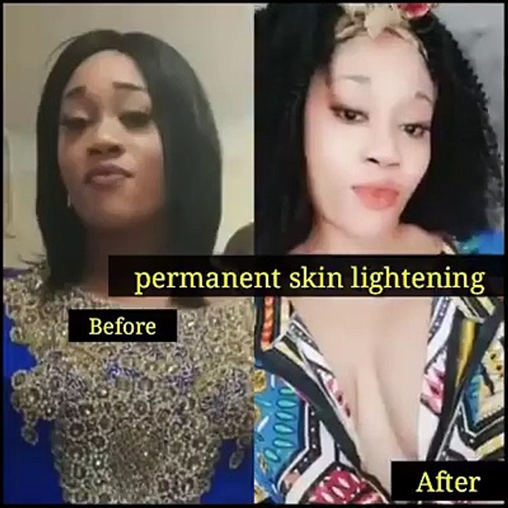 SKIN LIGHTENING CREAM IN Carletonville +27731769304Skin lightening in Rustenburg Skin lightening in Northern Cape Skin lightening in Kimberley Skin lightening in Kuruman Skin lightening in Port Nolloth Skin lightening in Western Cape Skin lightening in Be