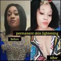 SKIN LIGHTENING CREAM IN Carletonville +27731769304Skin lightening in Rustenburg Skin lightening in Northern Cape Skin lightening in Kimberley Skin lightening in Kuruman Skin lightening in Port Nolloth Skin lightening in Western Cape Skin lightening in Be