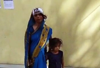 ग्राम चकवा खुर्द में सास ने बहू के साथ मिलकर छोटी बहू को किया लहूलुहान