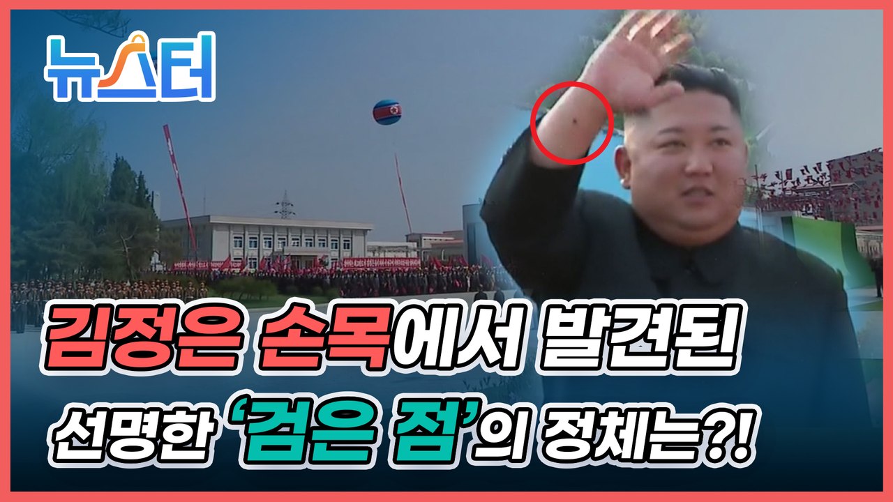 건재 과시하며 나타났지만 여전히 계속되는 설... 이번엔 김정은 손목에 수상한 점 포착?![뉴스터]
